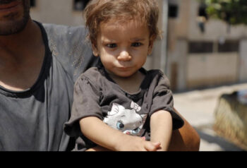 Malnourished Children Basket